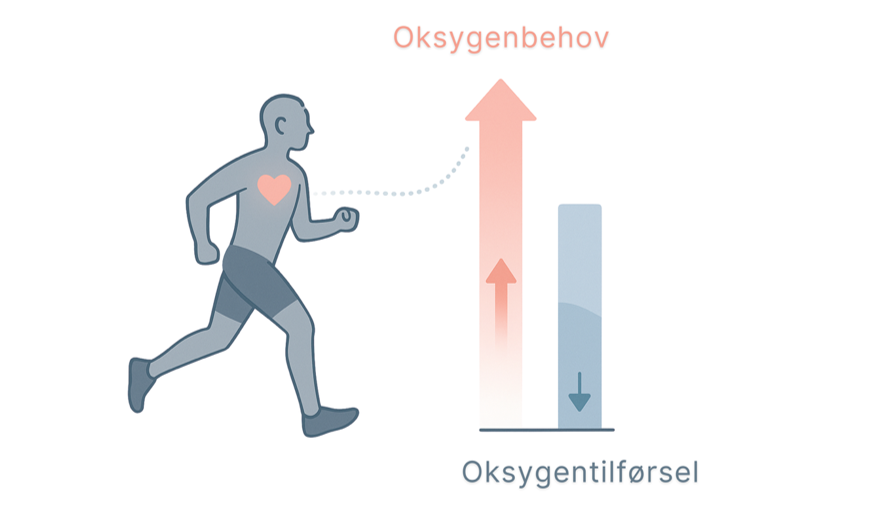 Anginasmerter: Illustrasjon av oksygenbehov og -tilf&oslash;rsel