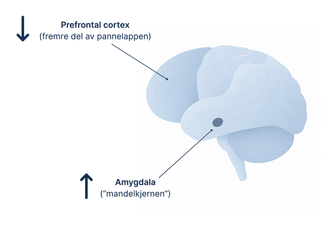 Illustrasjon av en hjerne sett fra siden. To områder er merket: Prefrontal cortex (fremre del av pannelappen) med pil nedover, og amygdala (“mandelkjernen”) med pil oppover.