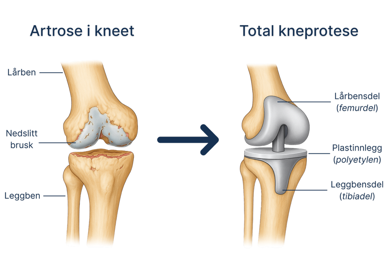 Et bilde som inneholder ledd og sko. KI-generert innhold kan v&aelig;re feil.