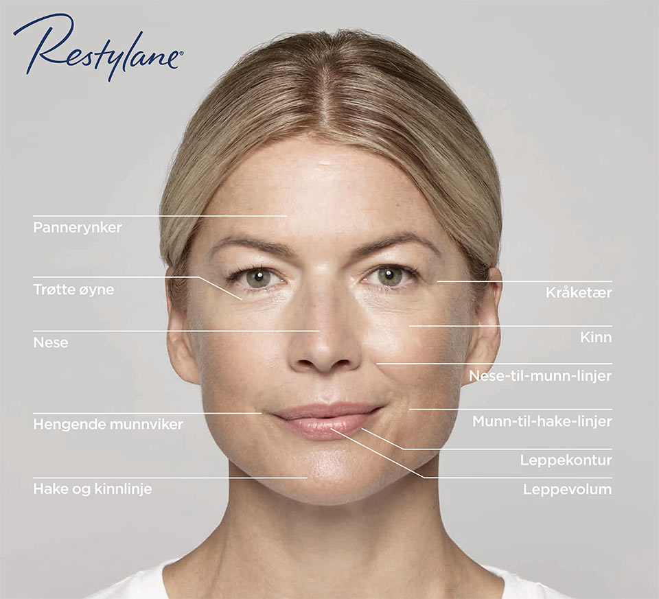 Restylane, ansiktsfigur: Pannerynker, Trøtte øyne, Nese, Hengende munnviker, Hake og kinnlinje, Kråketær, Kinn, Nese-til-munn-linjer, Munn-til-hake-linjer, Leppekontur, Leppevolum