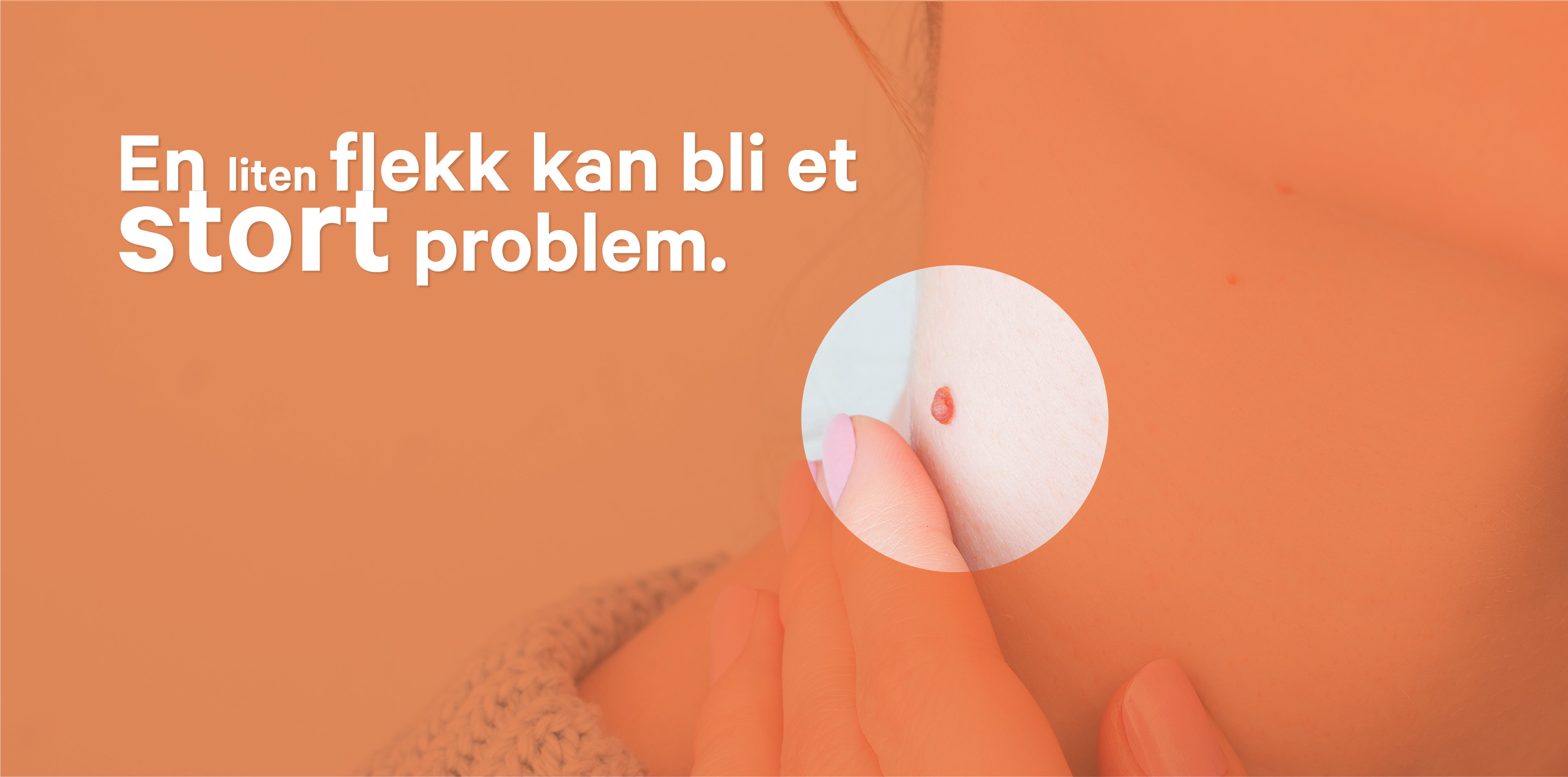 Ta hudsjekken!