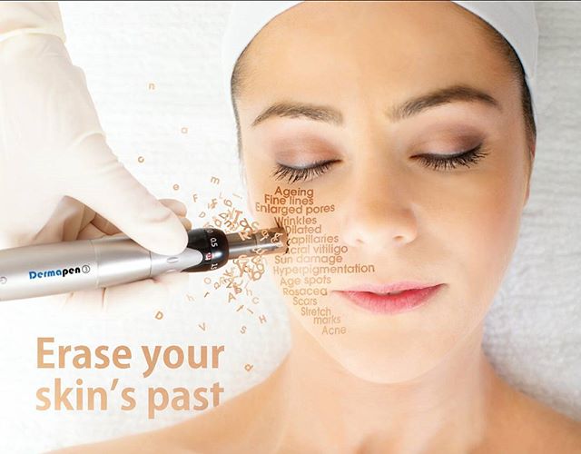 Dermapen, Kosmetiske behandlinger Volvat